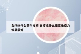 食疗吃什么管牛皮癣 食疗吃什么提高免疫力效果最好