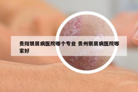 贵阳银屑病医院哪个专业 贵州银屑病医院哪家好