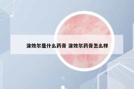 涂效尔是什么药膏 涂效尔药膏怎么样