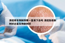 溃结用生物制剂要一直用下去吗 溃结免疫制剂好还是生物制剂好