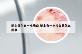 腿上偶尔有一小块白 腿上有一小片白是怎么回事