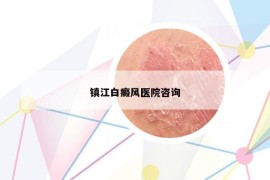 镇江白癜风医院咨询