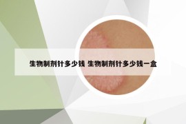 生物制剂针多少钱 生物制剂针多少钱一盒