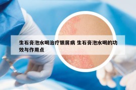 生石膏泡水喝治疗银屑病 生石膏泡水喝的功效与作用点