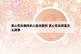 离心型白癜风的人能纹眉吗 离心性白斑是怎么回事