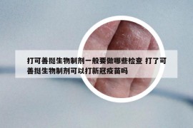 打可善挺生物制剂一般要做哪些检查 打了可善挺生物制剂可以打新冠疫苗吗