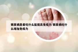 银屑病患者吃什么能提高免疫力 银屑病吃什么增加免疫力