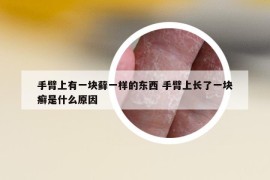 手臂上有一块藓一样的东西 手臂上长了一块癣是什么原因