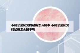 小腿总是反复的起癣怎么回事 小腿总是反复的起癣怎么回事啊