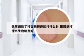 银屑病除了打生物挤还能打什么针 银屑病打什么生物制剂好