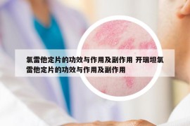 氯雷他定片的功效与作用及副作用 开瑞坦氯雷他定片的功效与作用及副作用