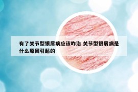 有了关节型银屑病应该咋治 关节型银屑病是什么原因引起的