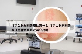 打了生物制剂需要注意什么 打了生物制剂需要注意什么可以吃其它药吗