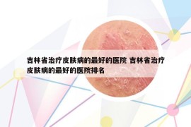 吉林省治疗皮肤病的最好的医院 吉林省治疗皮肤病的最好的医院排名