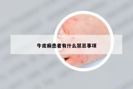 牛皮癣患者有什么禁忌事项