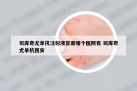 司库奇尤单抗注射液甘肃哪个医院有 司库奇尤单抗西安