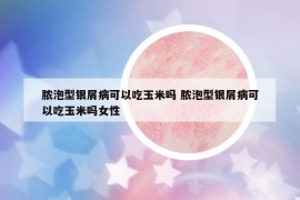 脓泡型银屑病可以吃玉米吗 脓泡型银屑病可以吃玉米吗女性