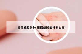 银屑病脱敏针 银屑病脱敏针怎么打