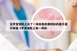 五岁宝宝脸上长了一块白色的像斑似的是不是不知道 5岁宝宝脸上有一块白