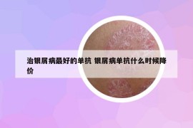 治银屑病最好的单抗 银屑病单抗什么时候降价