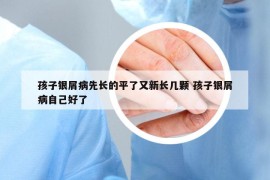 孩子银屑病先长的平了又新长几颗 孩子银屑病自己好了