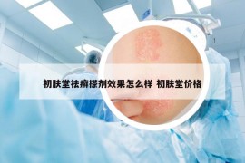 初肤堂祛癣搽剂效果怎么样 初肤堂价格