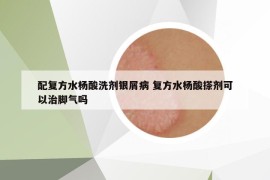 配复方水杨酸洗剂银屑病 复方水杨酸搽剂可以治脚气吗