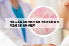 内蒙古易和皮肤病医院怎么样徐医生检解 呼和浩特易和皮肤病医院